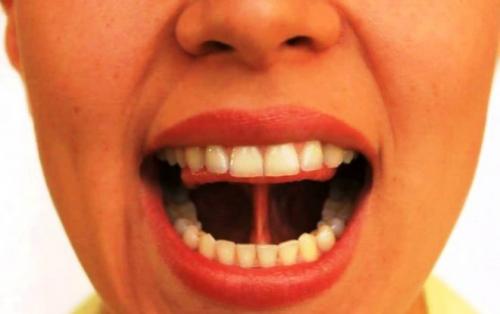 Артикуляционная гимнастика для звука Р. Артикуляционные упражнения для звука Р