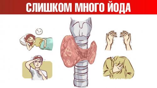 Чем опасен избыток йода: что нужно знать