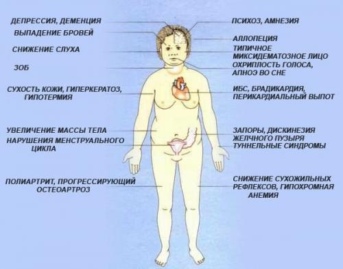 Йод в щитовидной железе: как происходит важнейший процесс 03 Йод в щитовидной железе: как происходит важнейший процесс 03