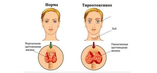 5 продуктов для здоровья щитовидки.  Профилактика заболеваний щитовидной железы йодом 02