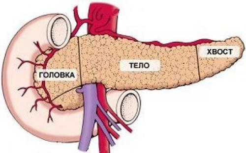 Удаление поджелудочной железы и жизнь без нее. Удаление головки поджелудочной железы 03