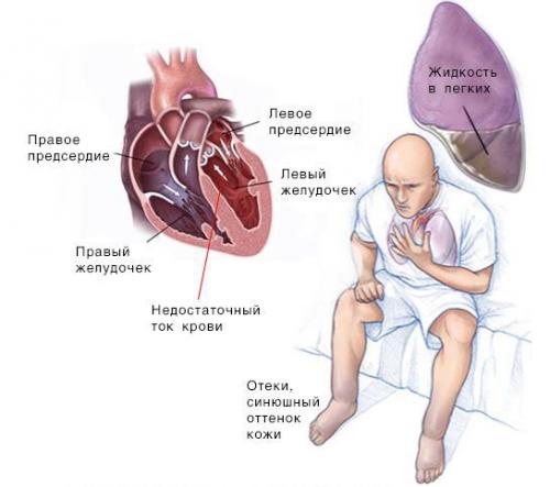 10 любимых продуктов нашего сердца. 6 главных правил употребления продуктов полезных для сердца 03 10 любимых продуктов нашего сердца. 6 главных правил употребления продуктов полезных для сердца 03