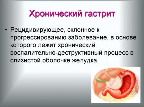 Сколько длится диета при гастрите. Диета вне обострения