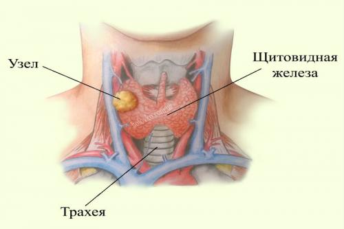 Гормоны щитовидной железы, симптомы. Ольга Гвоздева, эндокринолог. Редактор А. Герасимова