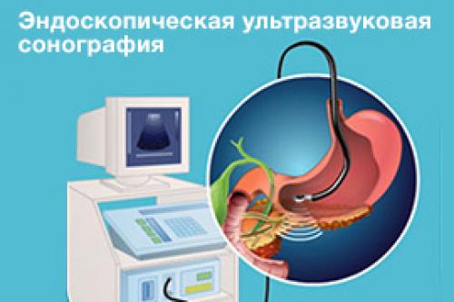 Практические рекомендации для пациентов с хроническим панкреатитом: как избежать обострений 15
