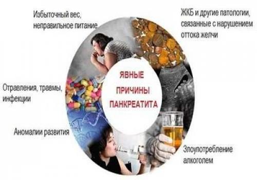 Практические рекомендации для пациентов с хроническим панкреатитом: как избежать обострений 16