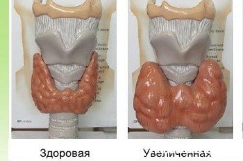 Какие факторы могут влиять на производство гормонов щитовидной железы. Структура щитовидной железы