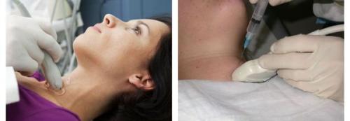 Важность гормонов щитовидной железы: как они влияют на организм 05