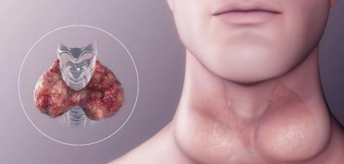 Важность анализа крови на гормоны щитовидной железы для диагностики 02