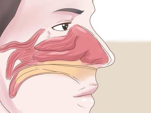 Народные средства от заложенности носа.