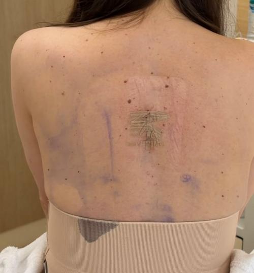 У Валерии Чекалиной выявили рак. 01