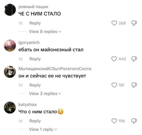 Токсиса раскритиковали за внешность - в Tiktok обсуждают, насколько сильно артист изменился за последние годы. 02