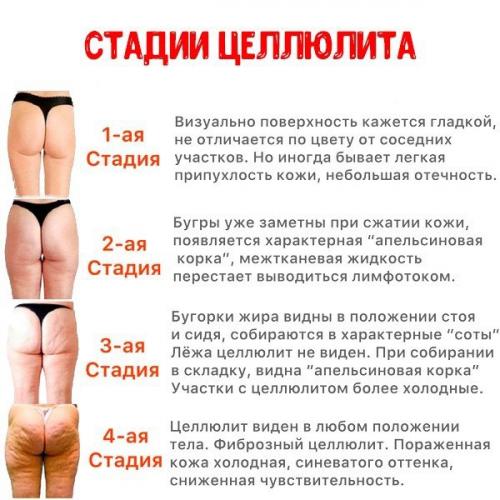 А вы знали, что основной причиной целлюлита является неправильное питание?