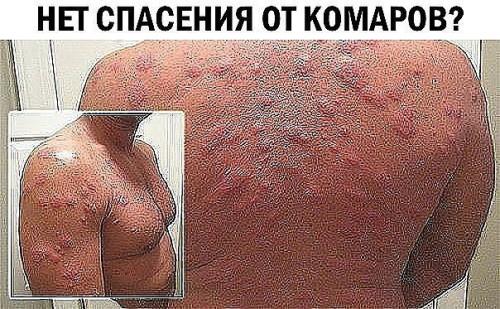 Совет дня.   Нет спасения от комаров?