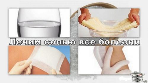 А вы знаете, что солевые повязки творят чудеса?
