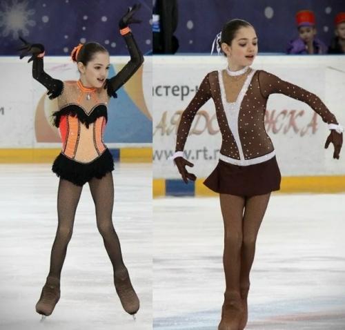 Меня так Сильно Травили за Этот нос: Евгения Медведева призналась, почему сделала ринопластику. 01