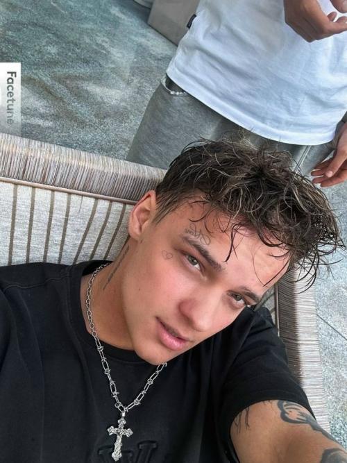 Егор шип о серьёзных проблемах со зрением рассказал. 

