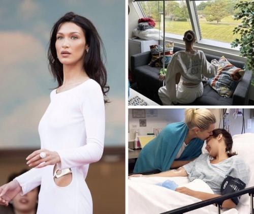 Бoлeзнь лaймa пpoгpeccиpуeт: у Бeллы xaдид oткaзывaют пoчки.